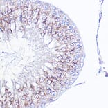 Immunohistochemistry - Anti-Integrin alpha V Antibody (A13861) - Antibodies.com