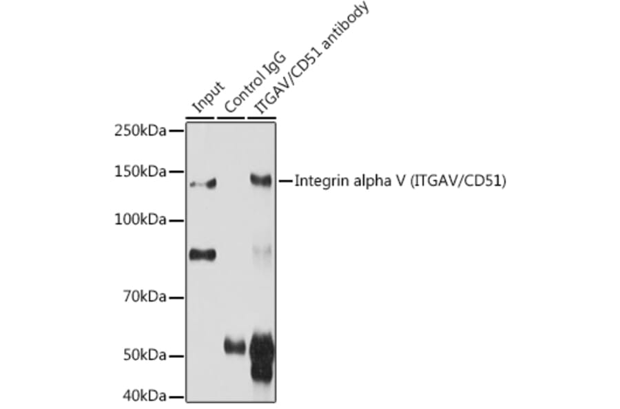 Western Blot - Anti-Integrin alpha V Antibody (A13861) - Antibodies.com