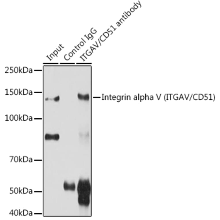 Western Blot - Anti-Integrin alpha V Antibody (A13861) - Antibodies.com