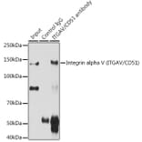 Western Blot - Anti-Integrin alpha V Antibody (A13861) - Antibodies.com