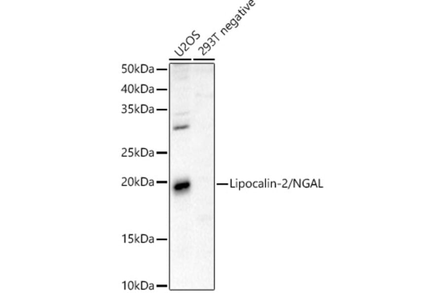 Western Blot - Anti-Lipocalin-2/NGAL Antibody (A13862) - Antibodies.com