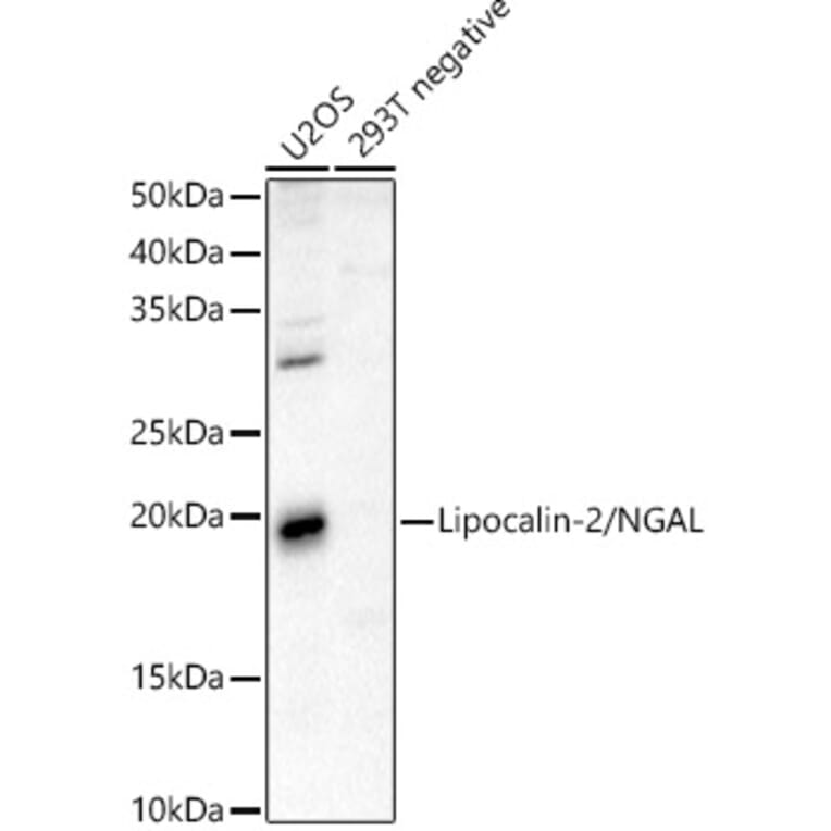 Western Blot - Anti-Lipocalin-2/NGAL Antibody (A13862) - Antibodies.com