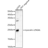 Western Blot - Anti-Lipocalin-2/NGAL Antibody (A13862) - Antibodies.com