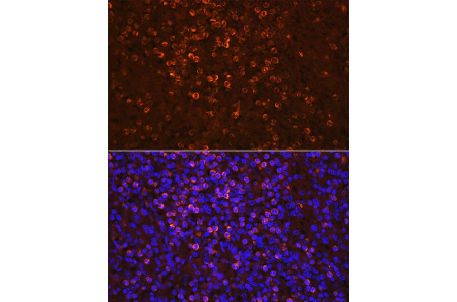Immunofluorescence - Anti-Lipocalin-2/NGAL Antibody (A13862) - Antibodies.com