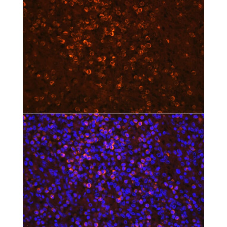 Immunofluorescence - Anti-Lipocalin-2/NGAL Antibody (A13862) - Antibodies.com