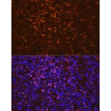 Immunofluorescence - Anti-Lipocalin-2/NGAL Antibody (A13862) - Antibodies.com