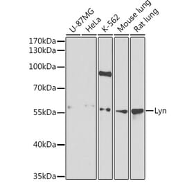 Western Blot - Anti-Lyn Antibody (A13863) - Antibodies.com