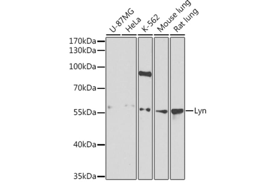 Western Blot - Anti-Lyn Antibody (A13863) - Antibodies.com