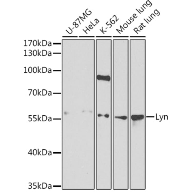 Western Blot - Anti-Lyn Antibody (A13863) - Antibodies.com