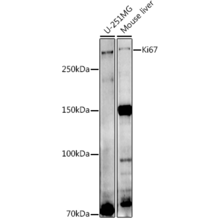 Western Blot - Anti-Ki67 Antibody (A13864) - Antibodies.com