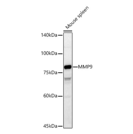 Western Blot - Anti-MMP9 Antibody (A13865) - Antibodies.com