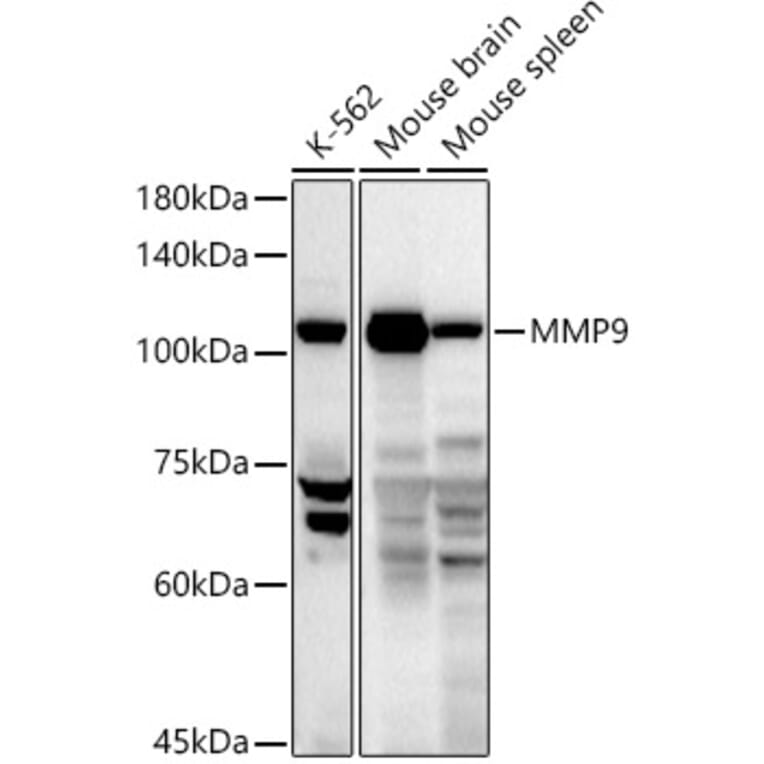 Western Blot - Anti-MMP9 Antibody (A13865) - Antibodies.com