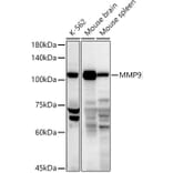 Western Blot - Anti-MMP9 Antibody (A13865) - Antibodies.com