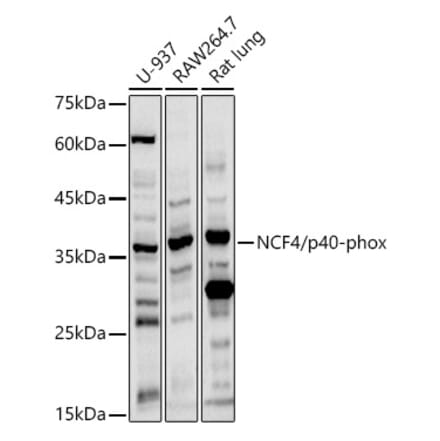 Western Blot - Anti-p40-phox Antibody (A13866) - Antibodies.com
