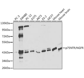 Western Blot - Anti-p75 NGF Receptor Antibody (A13867) - Antibodies.com