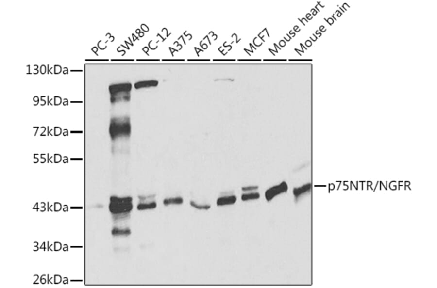 Western Blot - Anti-p75 NGF Receptor Antibody (A13867) - Antibodies.com