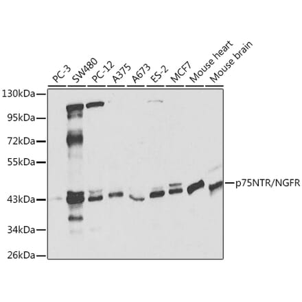 Western Blot - Anti-p75 NGF Receptor Antibody (A13867) - Antibodies.com