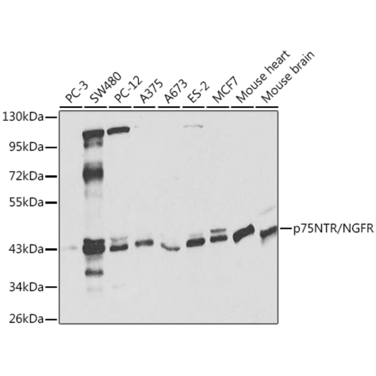 Western Blot - Anti-p75 NGF Receptor Antibody (A13867) - Antibodies.com