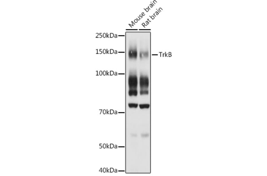 Western Blot - Anti-TrkB Antibody (A13868) - Antibodies.com