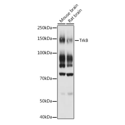 Western Blot - Anti-TrkB Antibody (A13868) - Antibodies.com