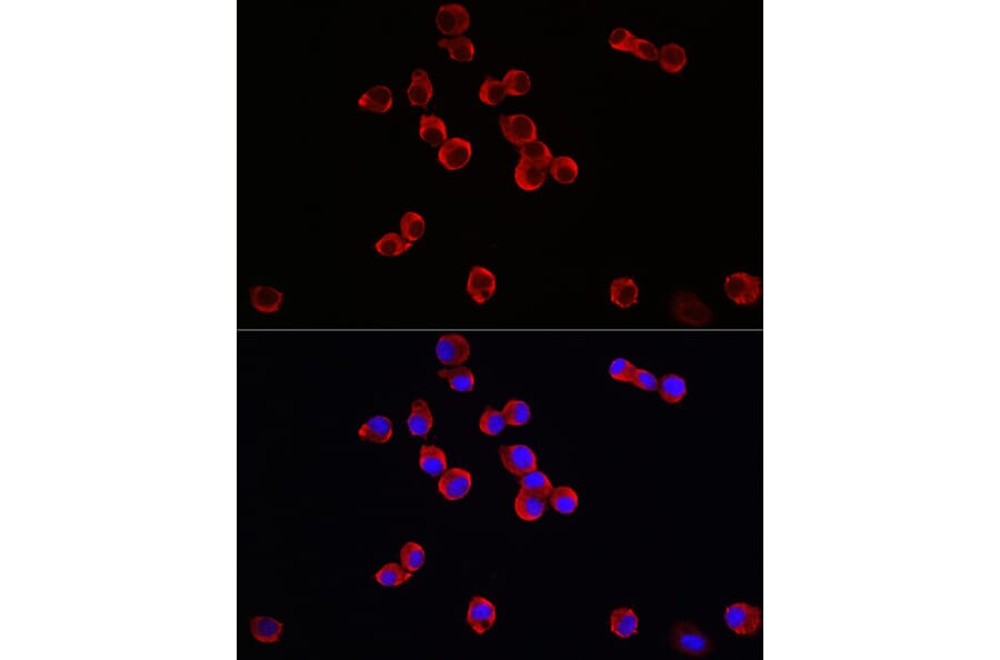 Immunofluorescence - Anti-TrkB Antibody (A13868) - Antibodies.com