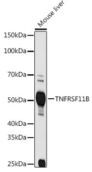 Western blot analysis of extracts of various cell lines, using Anti-TNFRSF11B Antibody (A2100) at 1:1,000 dilution.
Secondary antibody: Goat Anti-Rabbit IgG (H+L) (HRP) (AS014) at 1:10,000 dilution.
Lysates / proteins: 25µg per lane.
Blocking buffer: 3% non-fat dry milk in TBST.