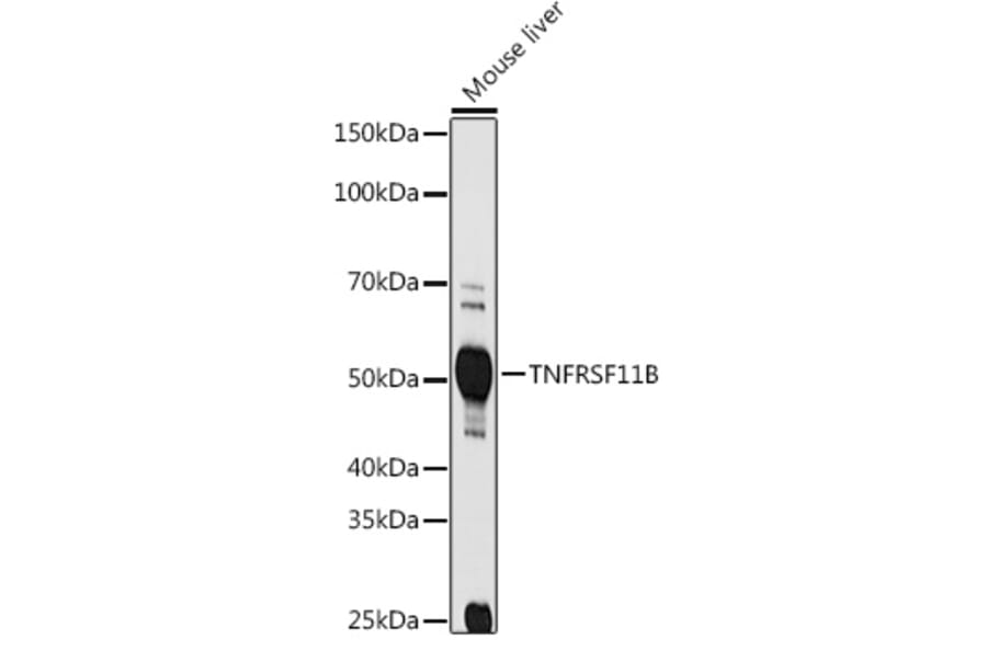 Western Blot - Anti-Osteoprotegerin Antibody (A13869) - Antibodies.com