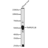 Western Blot - Anti-Osteoprotegerin Antibody (A13869) - Antibodies.com