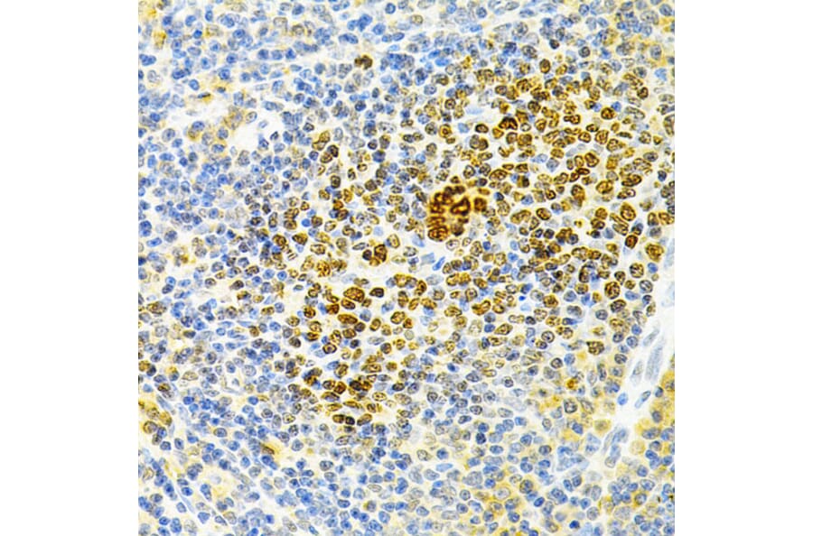 Immunohistochemistry - Anti-Osteoprotegerin Antibody (A13869) - Antibodies.com