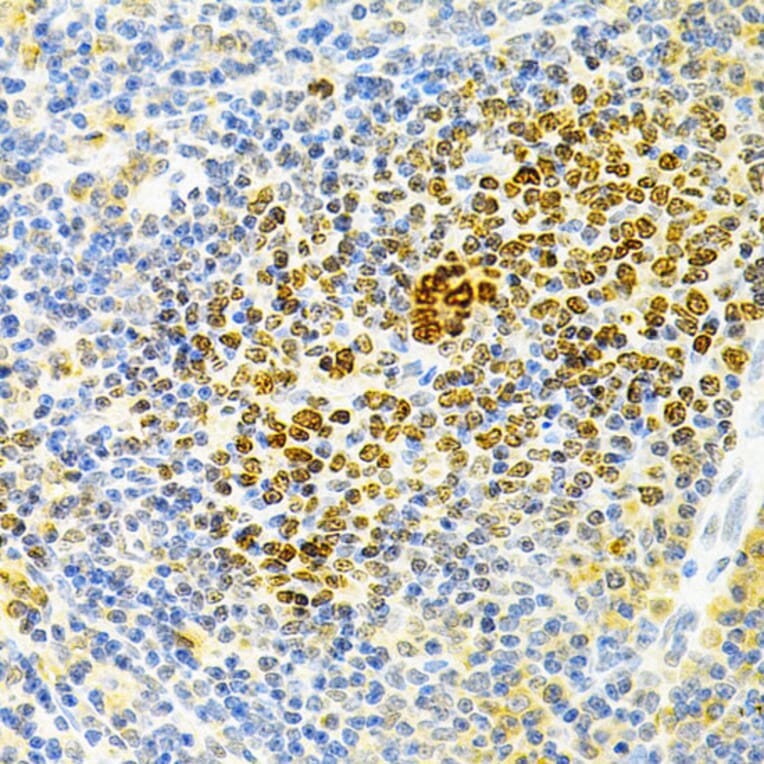 Immunohistochemistry - Anti-Osteoprotegerin Antibody (A13869) - Antibodies.com