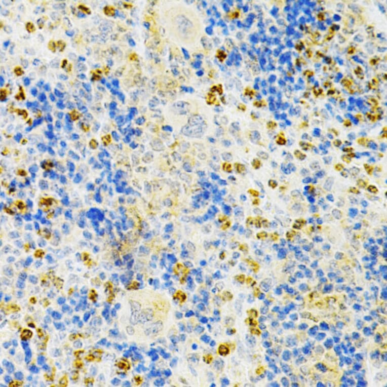 Immunohistochemistry - Anti-Osteoprotegerin Antibody (A13869) - Antibodies.com