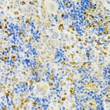 Immunohistochemistry - Anti-Osteoprotegerin Antibody (A13869) - Antibodies.com