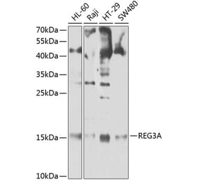 Western Blot - Anti-Reg3A Antibody (A13870) - Antibodies.com