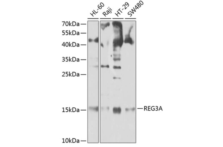 Western Blot - Anti-Reg3A Antibody (A13870) - Antibodies.com