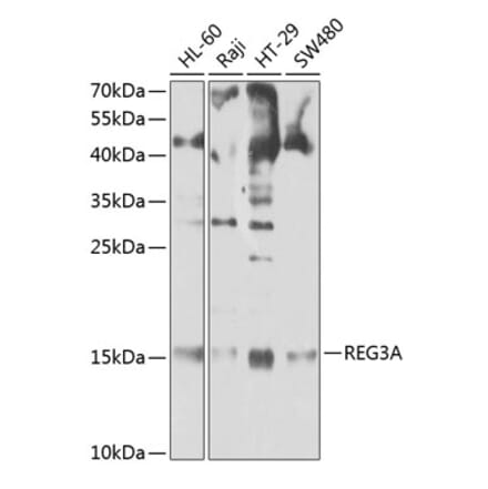 Western Blot - Anti-Reg3A Antibody (A13870) - Antibodies.com