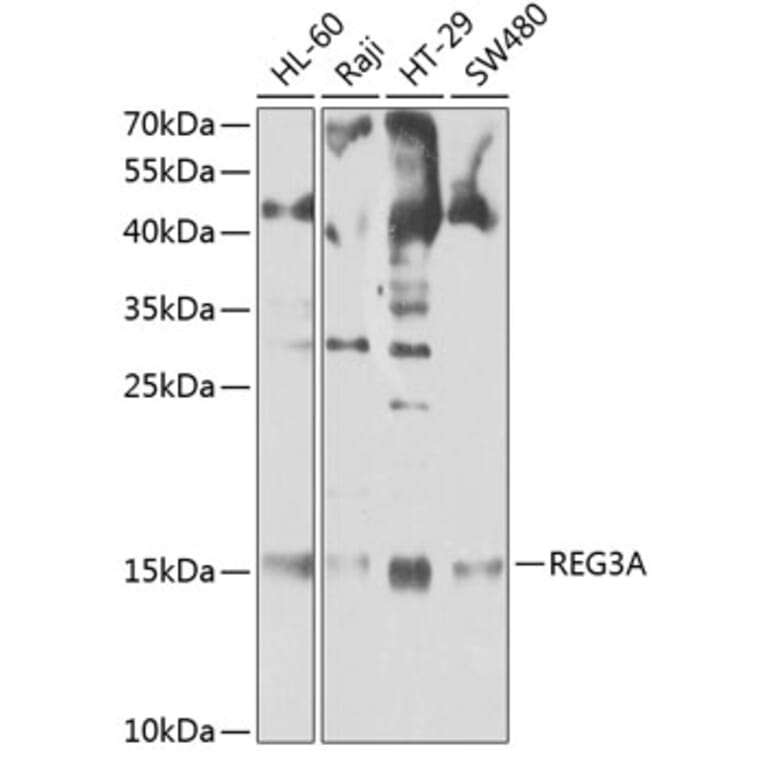 Western Blot - Anti-Reg3A Antibody (A13870) - Antibodies.com