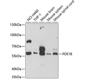 Western Blot - Anti-PDE1B Antibody (A13871) - Antibodies.com