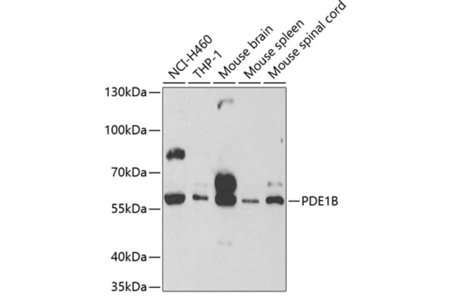 Western Blot - Anti-PDE1B Antibody (A13871) - Antibodies.com