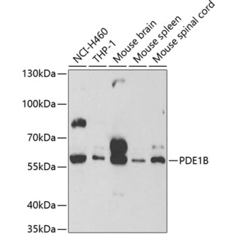 Western Blot - Anti-PDE1B Antibody (A13871) - Antibodies.com