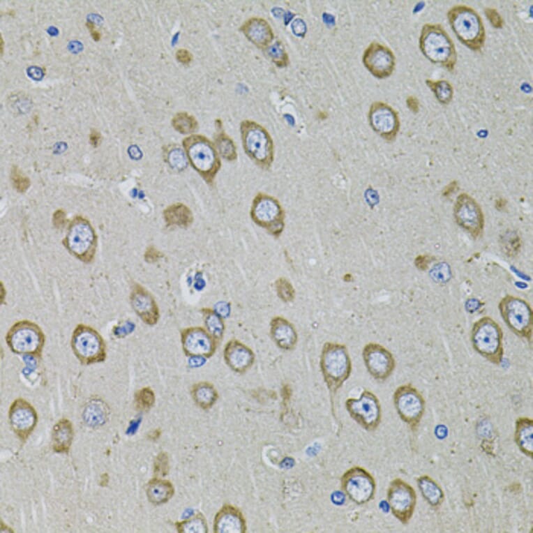 Immunohistochemistry - Anti-PDE1B Antibody (A13871) - Antibodies.com