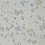 Immunohistochemistry - Anti-PDE1B Antibody (A13871) - Antibodies.com