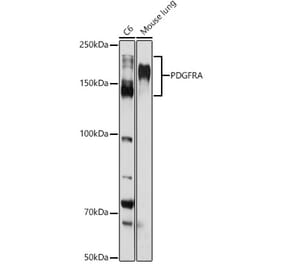 Western Blot - Anti-PDGFR alpha Antibody (A13872) - Antibodies.com