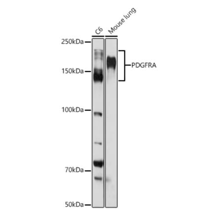 Western Blot - Anti-PDGFR alpha Antibody (A13872) - Antibodies.com