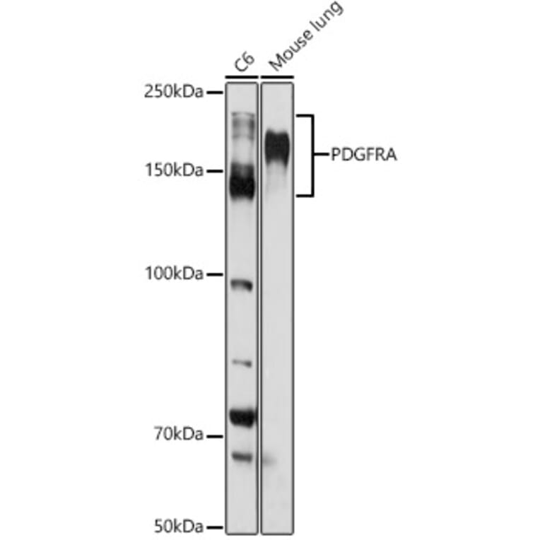 Western Blot - Anti-PDGFR alpha Antibody (A13872) - Antibodies.com