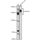 Western Blot - Anti-PDGFR alpha Antibody (A13872) - Antibodies.com