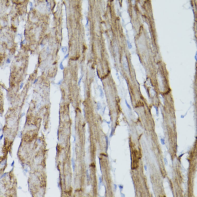 Immunohistochemistry - Anti-PDGFR alpha Antibody (A13872) - Antibodies.com
