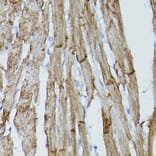 Immunohistochemistry - Anti-PDGFR alpha Antibody (A13872) - Antibodies.com