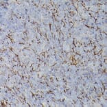 Immunohistochemistry - Anti-PDGFR alpha Antibody (A13872) - Antibodies.com