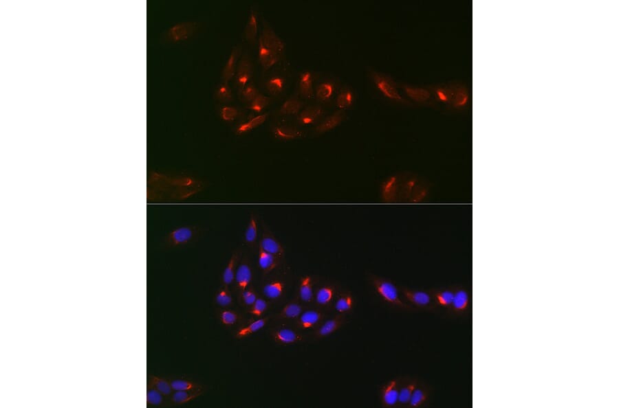 Immunofluorescence - Anti-PDGFR alpha Antibody (A13872) - Antibodies.com