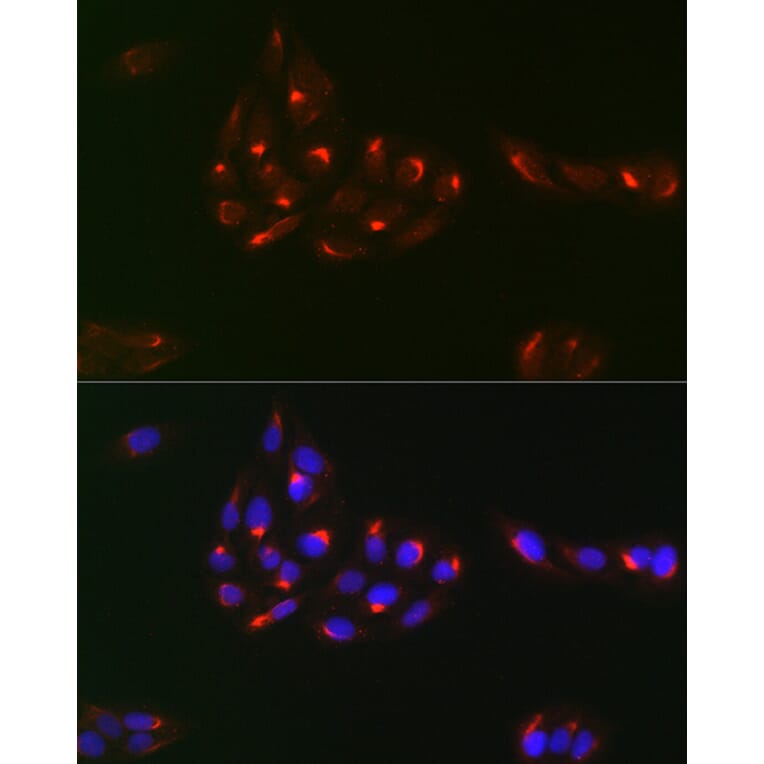 Immunofluorescence - Anti-PDGFR alpha Antibody (A13872) - Antibodies.com